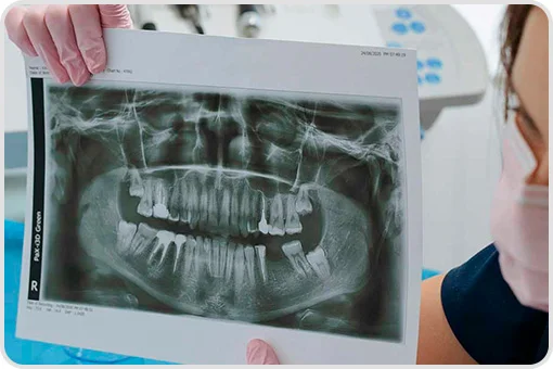Dentist in Coyoacán showing a panoramic dental x-ray for professional diagnosis, ideal for those looking for a dentist near me.